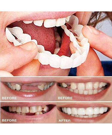 Fake Tooth Repair Kits for Filling The Missing Broken Tooth and Gaps-Moldable Fake Teeth and Thermal Beads Replacement Kits - Buy Online on SooperMarket.com