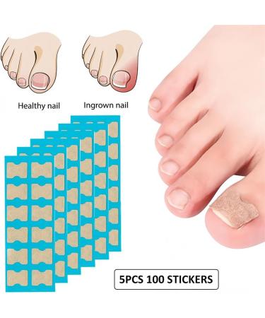 Toenail Patch Ingrown Toenail Toenail Correction Toenail Correction Patch Toenail Correction Patch Ingrown Toenail Nail Care 50 Pieces - Buy Online on SooperMarket.com