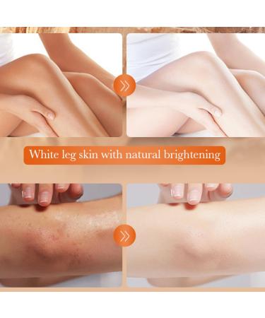 5.2oz Dark Knuckle Whitening Cream - Dark Spot Corrector for Knees Elbows & Neck - Moisturizing Skin Bleaching with Niacinamide & Vitamin C - Buy Online on SooperMarket.com