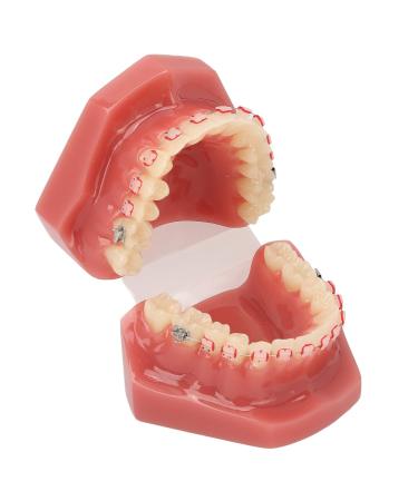 Orthodontic Demonstration Model for Dental Research | Metal Wires & Ceramic Brackets | Teaching Aids for Adults - Buy Internationally - Buy Online on SooperMarket.com