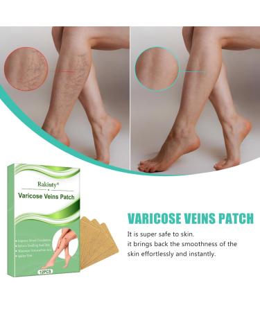 Varicose Veins Patch - Effective Treatment for Spider Veins | 12 Pcs | Fast International Shipping - Buy Online on SooperMarket.com