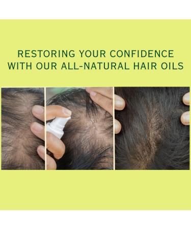 Hair Growth Advanced - Unisex Biotin & Rosemary Oil Formula for Thicker Fuller Hair | Combat Hair Loss & Damage Internationally Shipped - Buy Online on SooperMarket.com