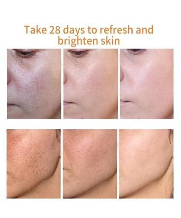 Dark Spot Remover Cream for Face, Body & Sensitive Areas - With Alpha Arbutin, Niacinamide, Collagen, Vitamin E - Powerful Age Spot Corrector - Buy Online on SooperMarket.com