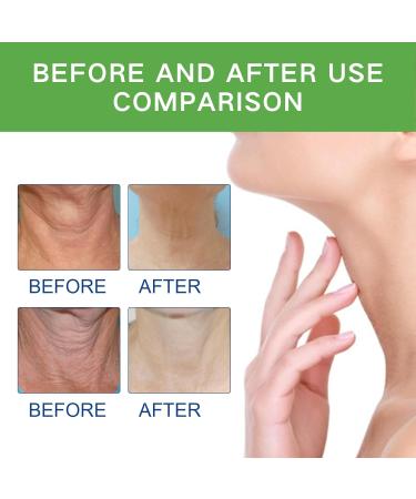 Neck Firming Cream Tighten and Lift Neck Cream Neck Line Remover Neck Tightening and Firming Vitamin C Vitamin E Moisturizing Anti Aging Reduce Neck Fine Lines Improve Roughness - Buy Online on SooperMarket.com
