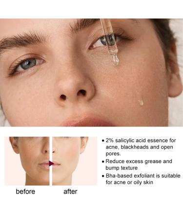 Rozino 3PC Face Serum Set | Advanced Collagen Boost Anti-Aging Solution for Glowing Skin - Buy Online on SooperMarket.com