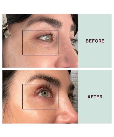 Dermaclara Siliconefusion Eyes and Mouth Patches - Reusable Hypoallergenic Silicone for Fine Lines, Wrinkles, Scars - 4 ct - Buy Online on SooperMarket.com