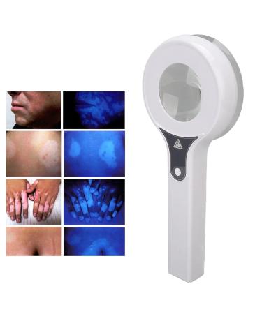 Woods Lamp Skin Analyzer - Portable Handheld UV Magnifying Machine for Accurate Skin Diagnosis - Buy Online on SooperMarket.com