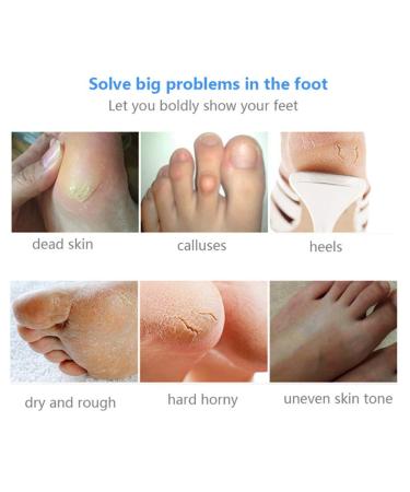 Onkessy Foot Peel Mask - Exfoliating Dead Skin Feet Repair Treatment - For Men and Women - Pedicure Spa - 1 Pair - Buy Online on SooperMarket.com