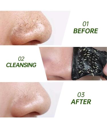 JVR Nose Strips for Blackhead Removal | Deep Cleansing Pore Strips with Charcoal & Witch Hazel | 10 Count for Oily Skin - Buy Online on SooperMarket.com