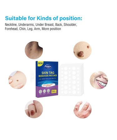 Skin Tag Remover Patches - 144Pcs | Safe & Painless Wart Removal for Face & Body - Buy Online on SooperMarket.com