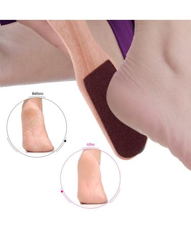 Gecheer Foot File Foot Rasp Hard Skin and Callus Remover Double Sided Foot File 2-way Pedicure Brush Foot File - Buy Online on SooperMarket.com