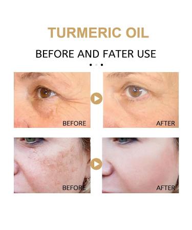 2022 Turmeric Dark Spot Corrector Serum for Face - Natural Skin Care Moisturizing Serum (2PCS-60ml) - Buy Online on SooperMarket.com