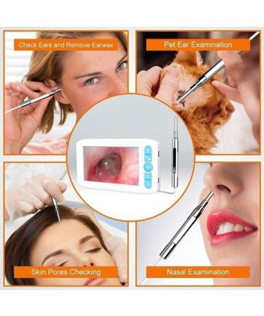 Marycan Ear Wax Removal Endoscope with 4.3 IPS Screen - FHD Smart Visual Ear Cleaner & Infection Detector | Plug & Play Kit for Home Use - Buy Online on SooperMarket.com
