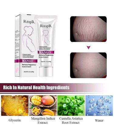 RtopR Mango Stretch Marks & Scar Cream - Pregnancy Safe Moisturizer - 80g (Pack of 2) - Buy Online on SooperMarket.com