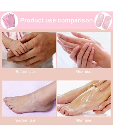 Moisturizing Gel Socks & Gloves Set for Softening Cracked Feet - Reusable Foot Care Spa Treatment (Pink) | International Shipping Available - Buy Online on SooperMarket.com