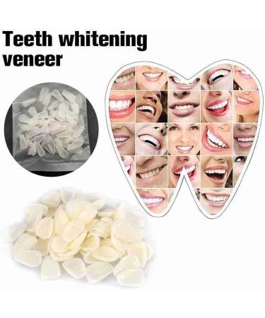 ChezMax Temporary Tooth Repair Kit - Fix Missing & Broken Teeth - Natural Solution - Buy Online on SooperMarket.com