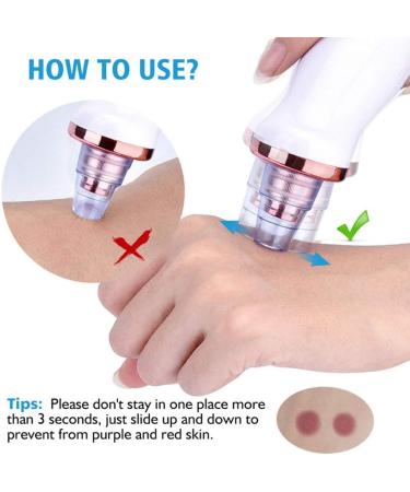 Rechargeable Blackhead Vacuum Remover with 5 Probes - Electric Facial Acne Suction Cleanser - Buy Online on SooperMarket.com