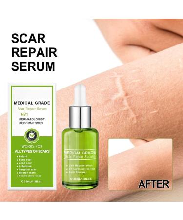 BEALIFE Belly Hip Chest Stretch Mark Removal Ladies Postpartum Body Burn Scars Repair Essence Anti-aging 30ml - Buy Online on SooperMarket.com