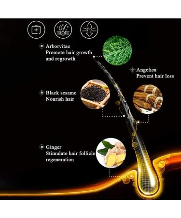 Hair Growth Serum Spray Hair Growth Accelerator Wild Growth Hair Ginger Oil for Hair Loss Treatments 20ML hair loss treatments - Buy Online on SooperMarket.com