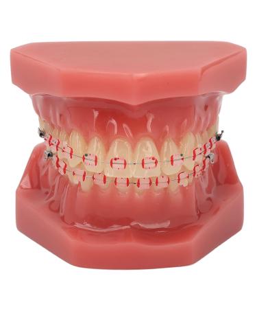Orthodontic Demonstration Model for Dental Research | Metal Wires & Ceramic Brackets | Teaching Aids for Adults - Buy Internationally - Buy Online on SooperMarket.com