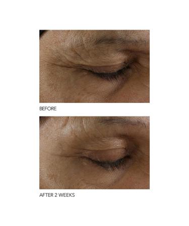 Dr Dennis Gross B Adaptive SuperFoods Stress SOS Eye Cream - 0.5 fl oz | Targets Tired Eyes, Worry Lines, Crepiness & Puffiness - Buy Online on SooperMarket.com