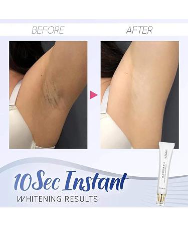 SnowySkin Legs Underarm Cream & Nose Strips Set - Instant Personal Skin Care | White | One Size - Buy Online on SooperMarket.com