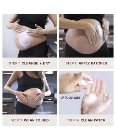 Buy Dermaclara Silicone Stretch Marks Patch Kit - Effective One Patch Solution for Scars | International Shipping Available - Buy Online on SooperMarket.com