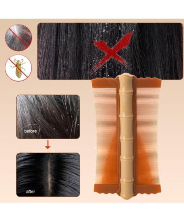 AMZLORD Lice Comb Flea Lice Removal Comb Double-sided Hair Nit Comb Fine Tooth Hair Grooming Comb Bamboo Shape for Cats Dogs Orange - Buy Online on SooperMarket.com