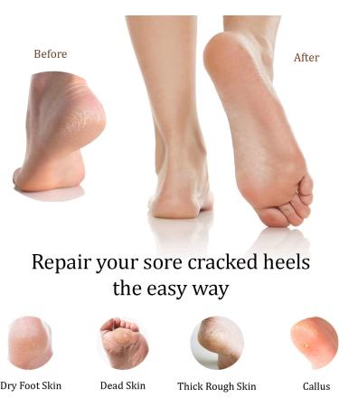 Moisturizing Heel Socks with Soft Gel Lining - Reusable Foot Moisturizer for Dry Cracked Feet - Pack of 2 - Buy Online on SooperMarket.com