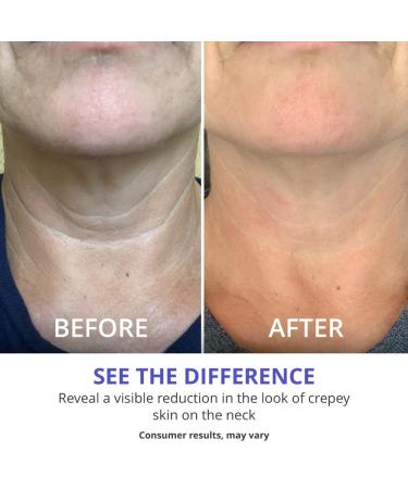 goPure Neck Firming Cream Anti-Aging Neck Cream for Tightening Wrinkles & Even Skin Tone | Pro-Active Firming Complex - 1.7 oz - Buy Online on SooperMarket.com