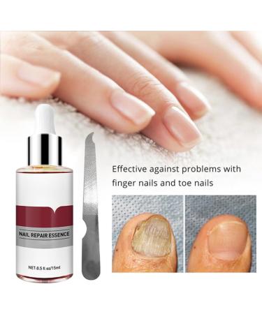 1PC Nail Treatment Toenail Treatment Nail Renewal Solution Toenails & Fingernails Nail Repairs Essential Oil Protects From Discoloration Brittle And Cracked Nail(12ML) - Buy Online on SooperMarket.com