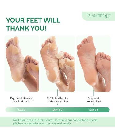Plantifique Foot Peeling Mask - Combo 4 Pack for Soft & Smooth Feet - Buy Online on SooperMarket.com