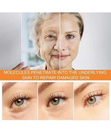 Dajidafu Portable Eye Dark Circle Spray Anti-age Anti-wrinkle Mist Sprays Moisturizing Hydrating Sprayer Wrinkle Remover Skin Care - Buy Online on SooperMarket.com