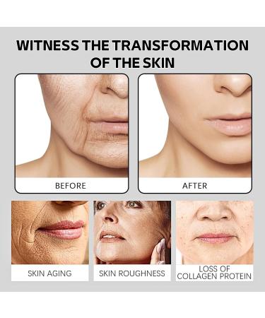 Bee Venom Face Serum Facial Firming Bee Venom Serum Hydrating Serum Anti Aging Serum for Face Collagen Boost Anti Wrinkle Serum Brightening Serums Skincare Bee Venom Essence - Buy Online on SooperMarket.com