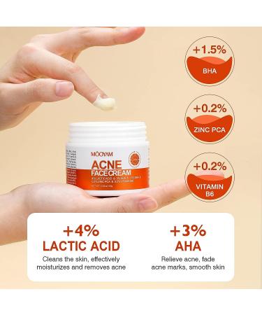 Salicylic Acid Acne Treatment Cream for Face & Body - Teens & Adults | Anti-Acne Moisturizer & Spot Treatment - Buy Online on SooperMarket.com