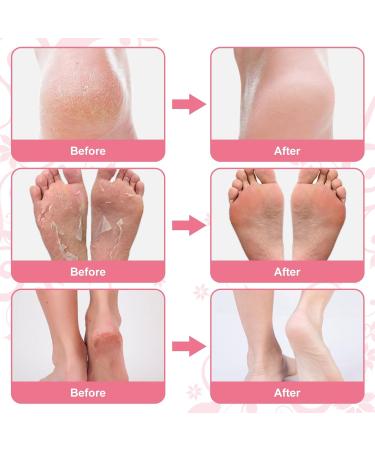 Exfoliating Foot Mask 4 Pairs Moisturizes Nourishes Foot Peel Mask Natural Ingredients Peel Away Hard Skin Calluses Renew Skin Repair And Soften Cracked Heels Feet Masks Exfoliating Socks - Buy Online on SooperMarket.com