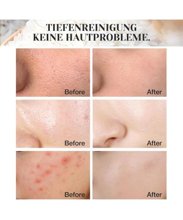 Shefave Rice Cleansing Foam Natural Cosmetics Facial Cleansing for Deep Pore Cleansing for Normal and Combination Skin Care Foam Against Blemished Skin on the Face - Buy Online on SooperMarket.com