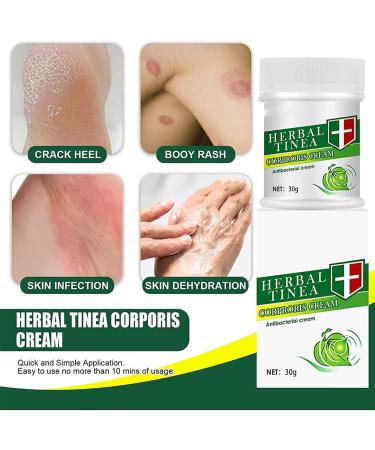 Endxedio Herbal Tinea Corporis Cream - Skin Relief & Anti-Itch Ointment (3pcs) - Buy Online on SooperMarket.com