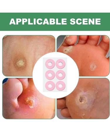 Virtcooy Round Corn Cushions - Corn Patches Foot Toes Corn Patches for Foot Toes Corn Cushion Pad Waterproof Corn Protectors Self-Adhesive for Secure Placement - Buy Online on SooperMarket.com