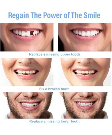 ChezMax Temporary Tooth Repair Kit - Fix Missing & Broken Teeth - Natural Solution - Buy Online on SooperMarket.com