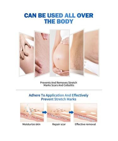 Belly Oil 90PCS | Stretch Mark Oil for Pregnancy | Improve Skin Elasticity & Nourish | Massage Oil for Moms - Buy Online on SooperMarket.com