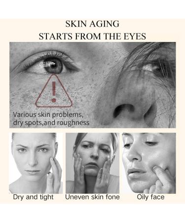 Trendyfave Freckles Brightening Essence Dark Spot Correcting Glow Serum Dark Spot Remover For Face& Neck Freckles Age Spot Remover For Face Skincare Brightening Serum With Glycerin 30 ml - Buy Online on SooperMarket.com