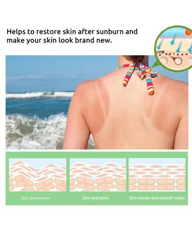 Skin Recovery Cream - Aloe After Sun Repair 100g (2pcs) | Hydrating Nourishing Lightweight Formula for Sunburn Relief & Dull Skin Repair - Buy Online on SooperMarket.com