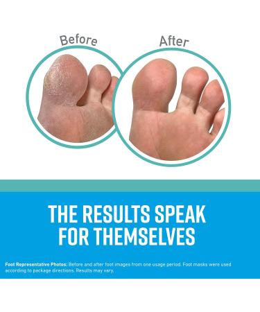 O'Keeffe's Healthy Feet Intensive Moisturizing Foot Mask Hydrating Repair for Dry Cracked Feet One Pair Single-Use Socks (Pack of 1) 107472 - Buy Online on SooperMarket.com