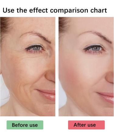 5 Seconds Wrinkle Remover 5 Seconds Retinol Anti-Wrinkle Cream 5 Seconds Anti Wrinkle Face Cream Instant Wrinkle Remover Lifting Moisturizing Facial Cream Tightening Face Cream or Women - Buy Online on SooperMarket.com