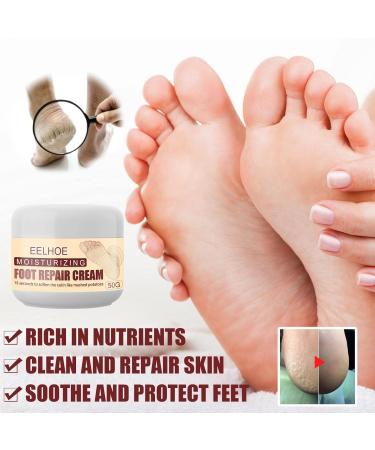 Vegan Foot Cream for Dry Rough & Cracked Feet | Best Callus Care - International Shipping - Buy Online on SooperMarket.com