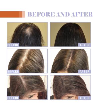 Hair Growth Oil - Hair Supplements For Women with Vitamin B6 Pumpkin Seed Oil For Skincare - Boost Hair Growth For Eyelashes Eyebrows & Dry Damaged Hair Moisturizer Face Hair - Buy Online on SooperMarket.com