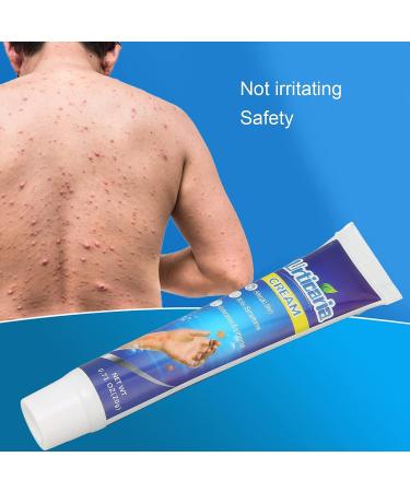 20g Anti-Itch Cream for Urticaria & Pruritus | Adjunctive Treatment for Dry Skin | Soothes Hives & E45 Itch Relief - Buy Online on SooperMarket.com