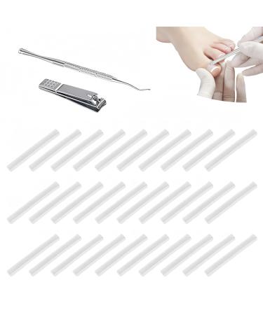 Corrective for Ingrown Nails Correction of Ingrown Nails Correction Kit 30 Pieces Correction Strips for Ingrown Nails Toe Nail Correction