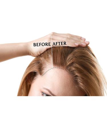 Buy 100% Pure Vitamin E Oil - 75 000 IU Full Spectrum D Alpha Tocopherol - 4 oz for Skin Hair & Nail Care | Hydrating Rejuvenating Oil Online - Buy Online on SooperMarket.com